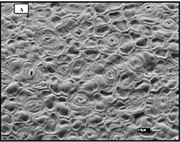 Microscopic view of coffee leaf cells