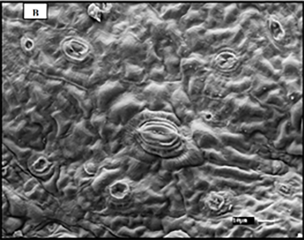 Microscopic view of coffee leaf cells